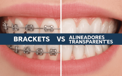 Invisalign vs Brackets: ¿Cuál es la mejor opción para alinear tu sonrisa?